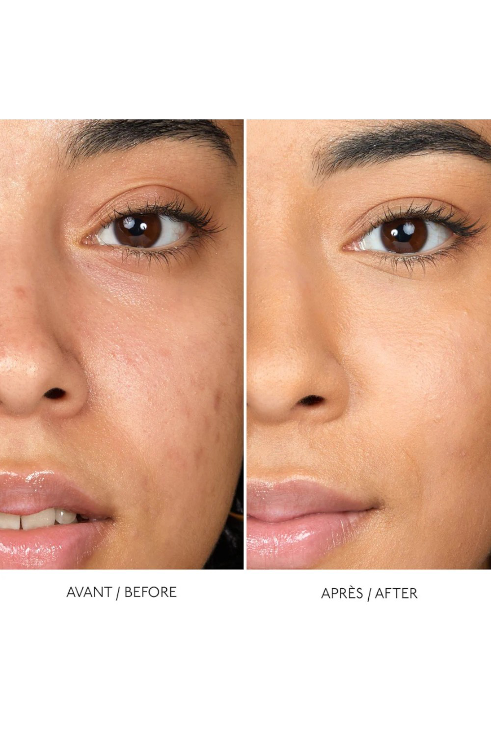 Hyaluronic Serum Concealer 8HA N8