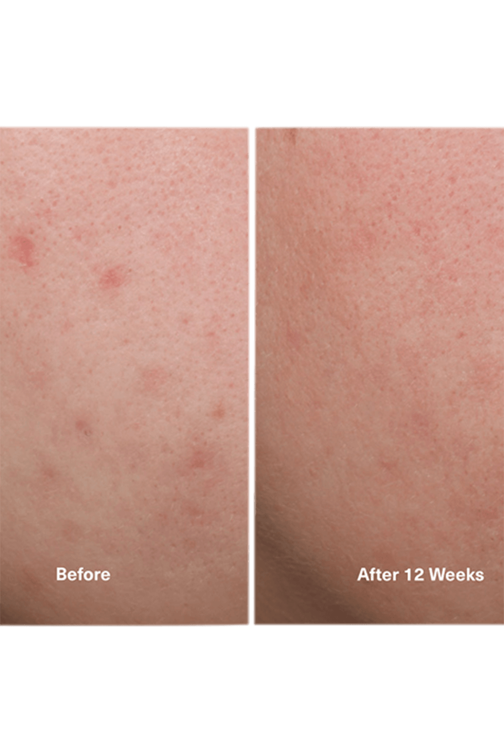 The Concentrate 30ml