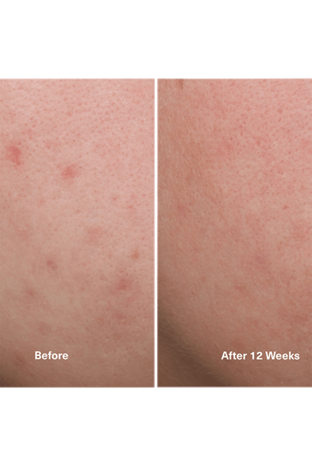 The Concentrate 50ml