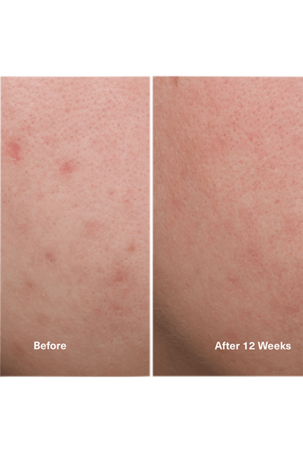 The Concentrate 15ml